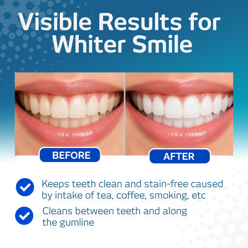 Vitis Whitening Mouthwash 500ml