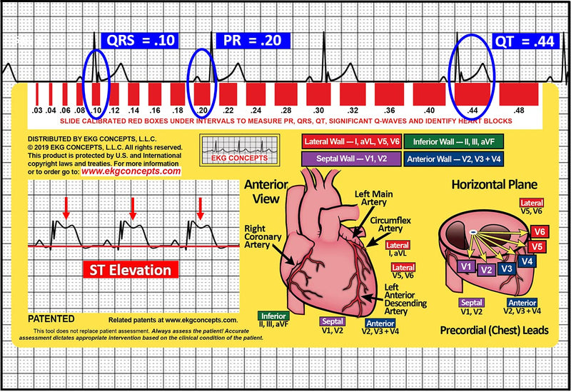 [Australia - AusPower] - R-CAT EKG Window 2nd Edition 