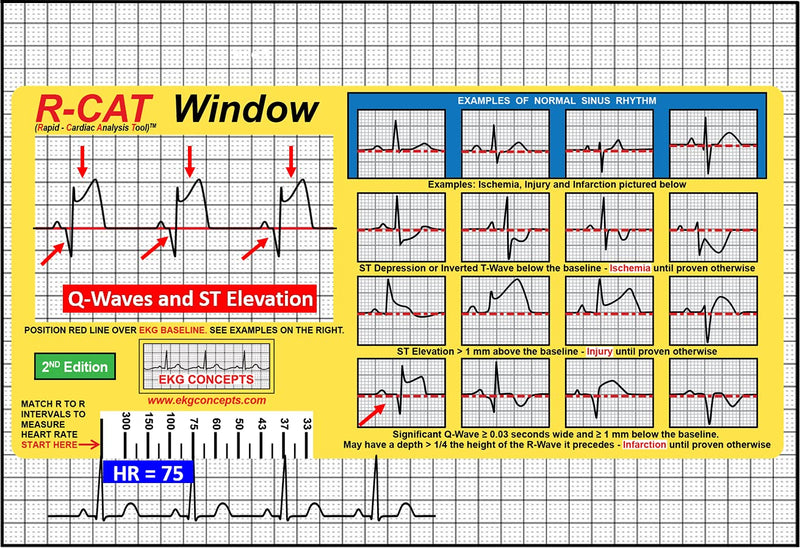 [Australia - AusPower] - R-CAT EKG Window 2nd Edition 