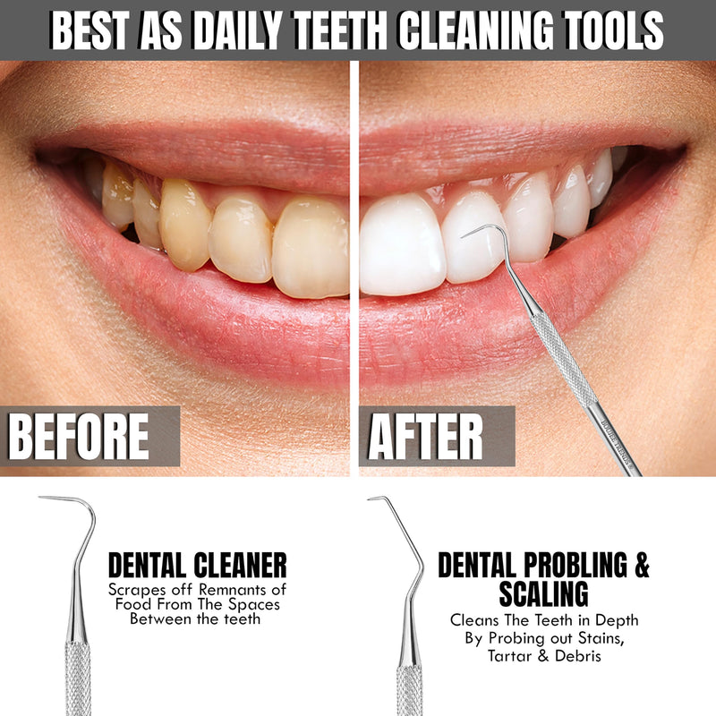 [Australia - AusPower] - Professional Dental Tools |Tartar Scraper for Dentist, Personal Use and Pets | Plaque Remover with Comfortable Grip, Double ended Hollow Scaler | Japanese Stainless Steel (Dental Probe, Polish) 