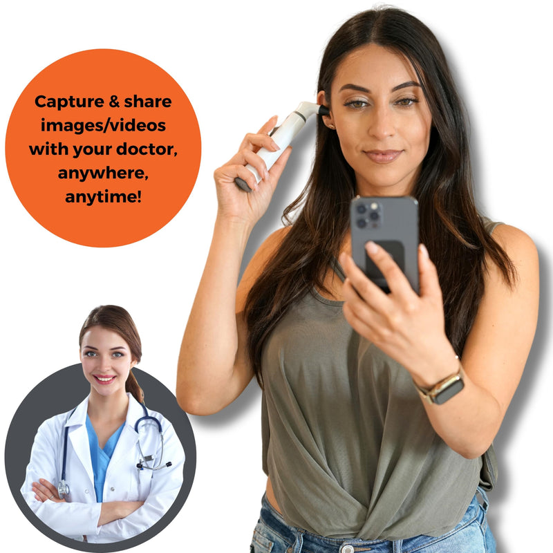 [Australia - AusPower] - MOBI Connect Wi-Fi Otoscope for Ears, Nose & Throat - 1080P HD Lens, Multi-Axis Gyroscope, 6 LED Lights, 90+ Min Use, 3 Ear Speculum, Suitable for Adults & Children 
