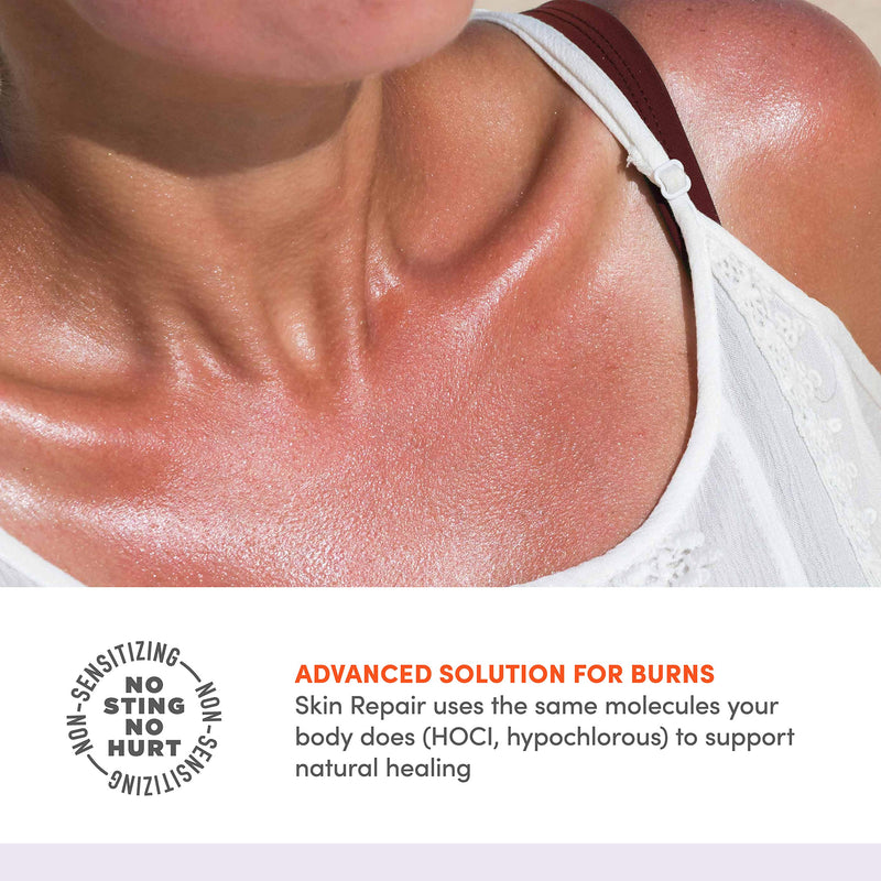 [Australia - AusPower] - Active Skin Repair First Aid Skin Healing Burn Hydrogel - Natural, Non-Toxic, & No Sting Skin Burn Ointment with Hypochlorus Acid for Immediate Pain Relief, HSA/FSA Eligible, 3 oz 