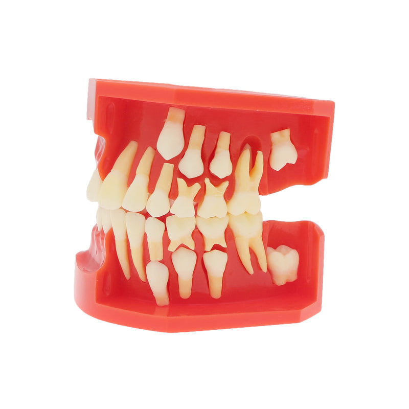 [Australia - AusPower] - Teeth Typodonts Dental Model #7013 - Teeth Eruption Development Model Alternating Model of Constant Pressure of Deciduous Teeth 
