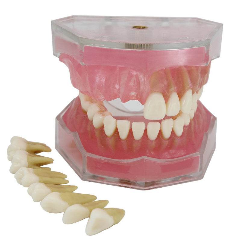 [Australia - AusPower] - Dental Implant Teeth Model Study Teach Standard Model with Removable Teeth 
