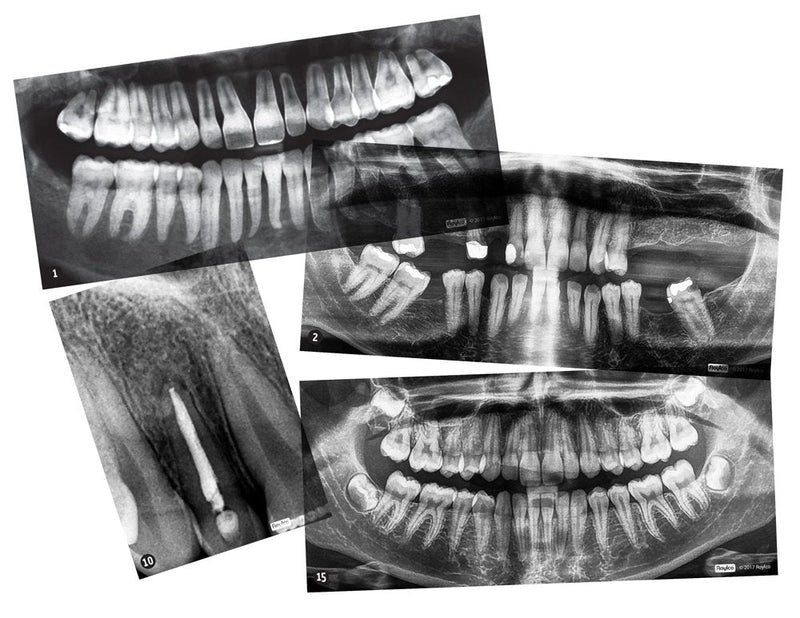 [Australia - AusPower] - Dental X-Rays 