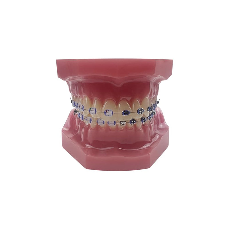 Orthodontic Tooth Model with Brackets, YOUYA DENTAL Demonstration Orthodontic Model for Education, Teeth Demonstration Typodonte Anatomical Teaching Tool with Metal and Ceramic Holder