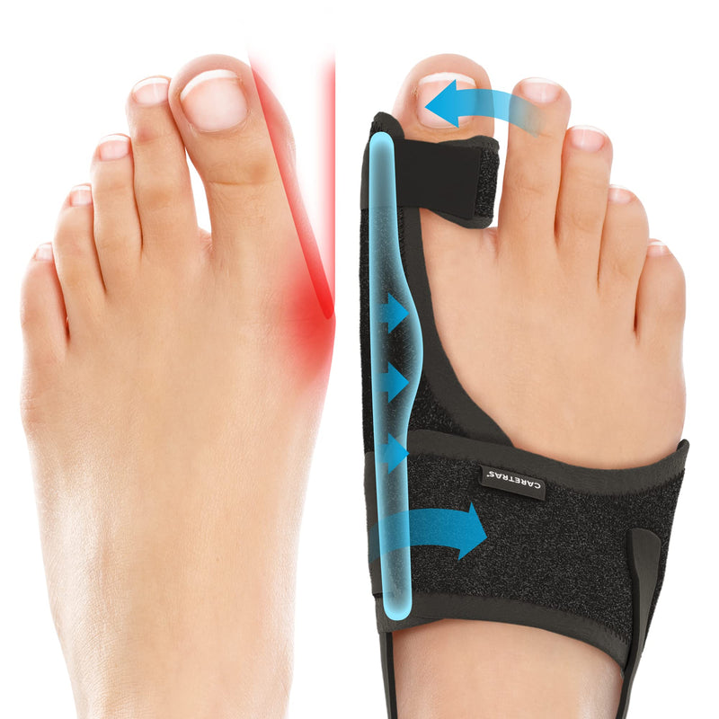 [Australia - AusPower] - Caretras Bunion Corrector, Orthopedic Bunion Splint, Big Toe Separator Pain Relief, Non-Surgical Hallux Valgus Correction, Hammer Toe Straightener, Day Night Support (Simple Elegant (2 Count)) 