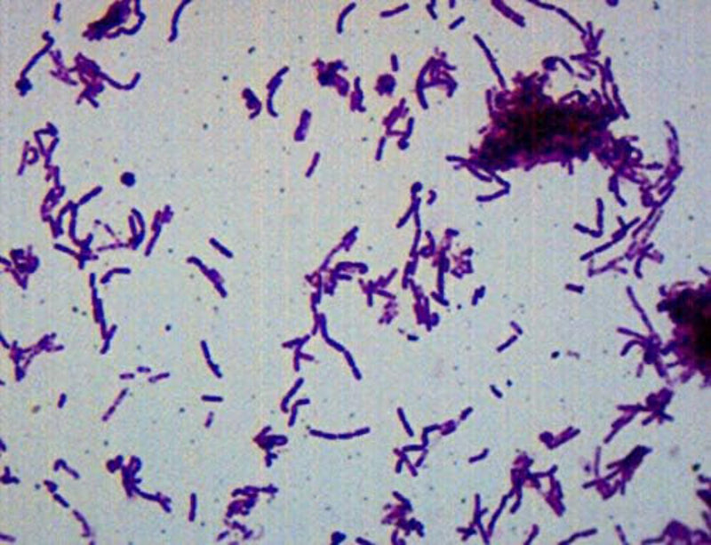 [Australia - AusPower] - EISCO Bacillus Smear, Gram Negative Stain - Prepared Microscope Slide - 75 x 25mm - Biology & Microscopy Single Slide 