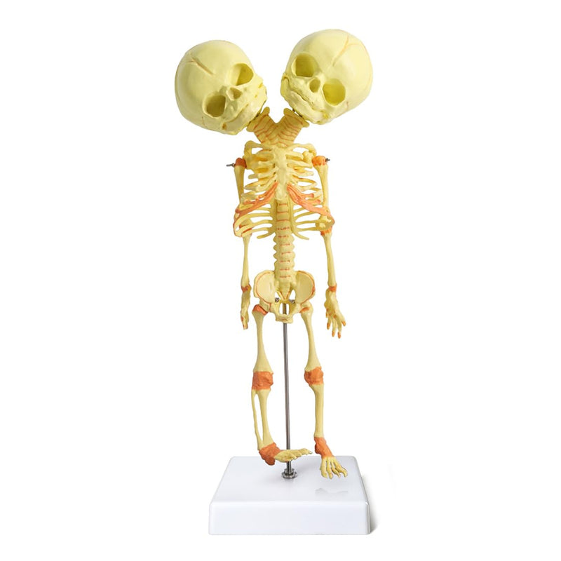 EVOTECH SCIENTIFIC Human Infant Skeleton Model, Twin-Skull, Human Fetus Skeleton W/Double-Skull Model for Medical Study Teaching Display