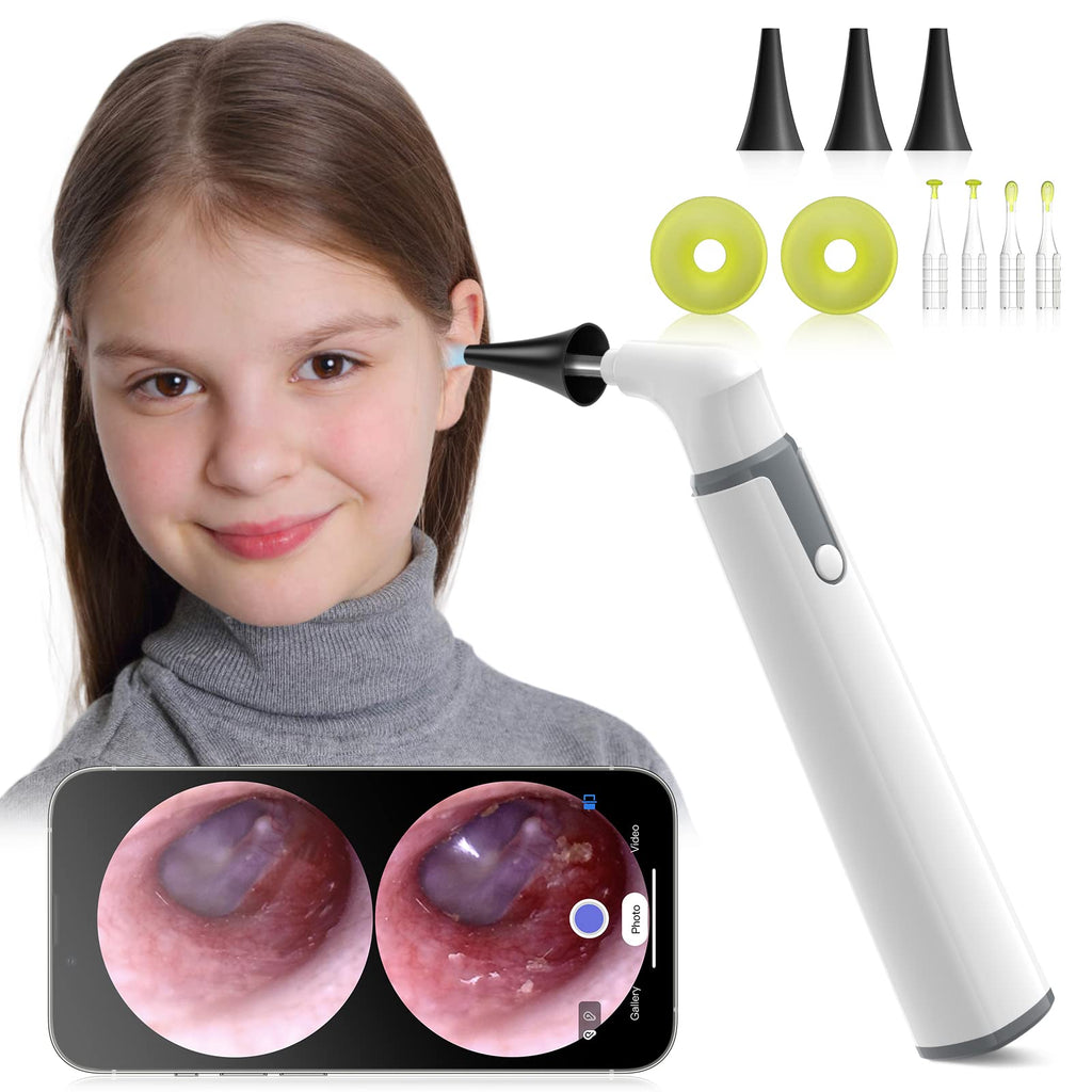 Anykit Wireless Otoscope Ear Camera with Dual View, 3.9mm 720PHD WiFi Ear Scope with Ear Wax Removal Tool for Kids and Adults & Pets, Compatible with Android and iPhone