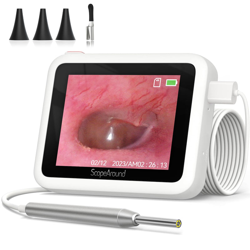 [Australia - AusPower] - ScopeAround Otoscope Ear Camera, 3.9mm Otoscope with Light, HD Ear Scope, Digital Otoscope for Kids and Adults Plug & Play Ear Wax Removal Tool Camera, Video Otoscope for Home Ear Inspection 