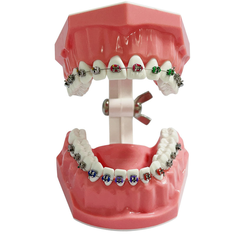 [Australia - AusPower] - Orthodontic Dental Model with Brackets for Educational Demonstration - Silicone Teeth Typodont with Braces, Anatomic Teaching Tool - Dental Care Training Device for Students and Patients 