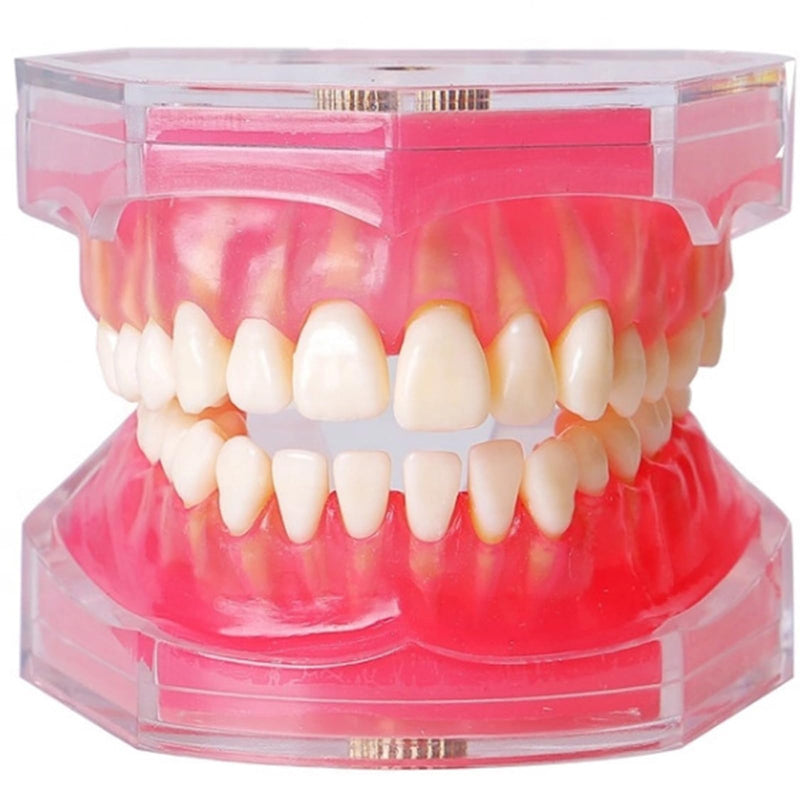 [Australia - AusPower] - Standard Study Teaching Dental Model with All Removable Teeth - Soft Silicone Gel Gum and Bendable Teeth Typodonts for Students and Professionals - Ideal for Dental Education and Demonstrations 