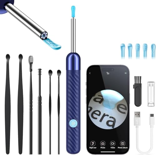 AOPICK HD Visual Ear Cleaner with WiFi, 1080P Wireless Camera with 6 LED Lights, 360° Wide Angle for Smartphones & Tablets Blue