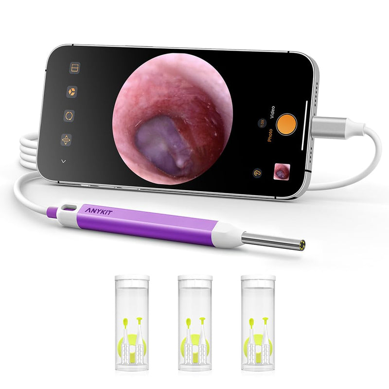 [Australia - AusPower] - Anykit Digital Otoscope with Gyroscope, HD Ultra Clear View Ear Camera with Ear Wax Removal Tools, Video Ear Scope Otoscope with Light, Compatible with Android, iPhone 15 (Purple) 