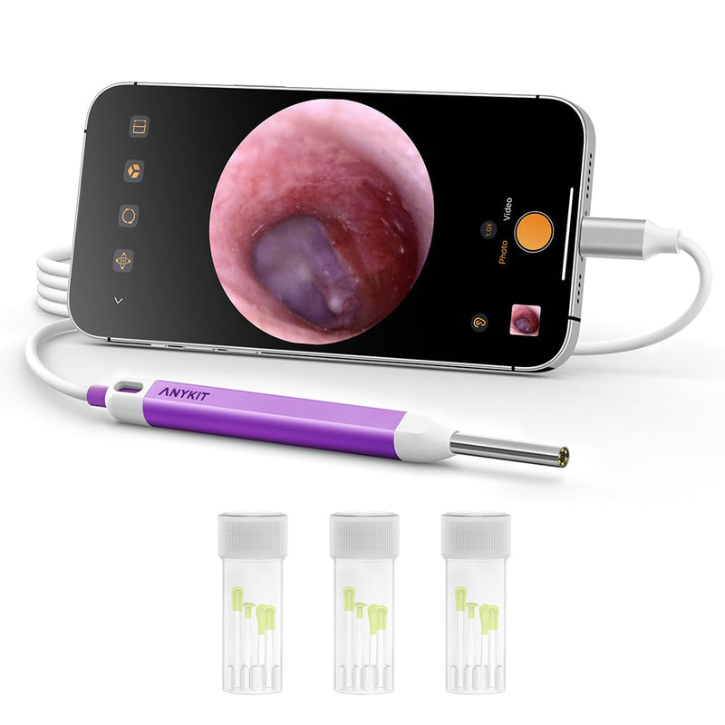 [Australia - AusPower] - Anykit Digital Otoscope with Gyroscope, HD Ultra Clear View Ear Camera with Ear Wax Removal Tools, Video Ear Scope Otoscope with Light, Compatible with Android, iPhone 15 (Purple) 