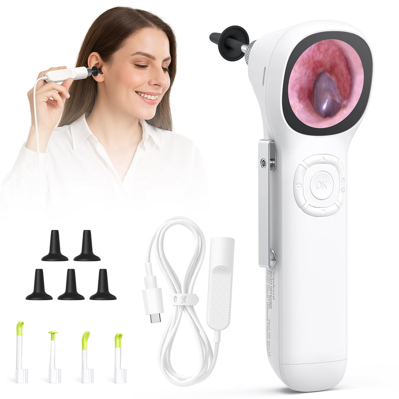 [Australia - AusPower] - ScopeAround Otoscope with Light, 720P HD Ear Cleaning Camera & 6 LED Lights Ear Scope, 1.45" IPS Display Digital Otoscope, Ear Scope with Extention Cable, Smart Ear Camera, Ready to Use White 