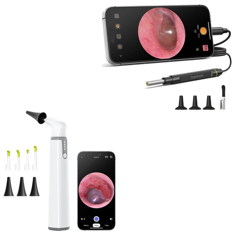 [Australia - AusPower] - ScopeAround Otoscope with Light, Ear Camera with Dual View, 720pHD/1080pFHD WiFi Ear Scope with 6 LED Lights, 3.9mm Lens Otoscope Camera for Kids and Adults, Ear Scope 