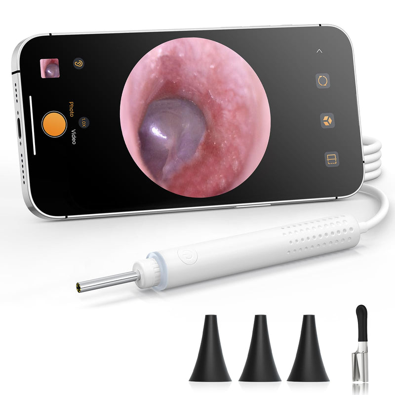 [Australia - AusPower] - ScopeAround Otoscope with Light, 720P HD Ear Cleaning Camera & 6 LED Lights Ear Scope, Digital Otoscope with Camera, Smart Endoscope, Plug & Play, USB-C Port 