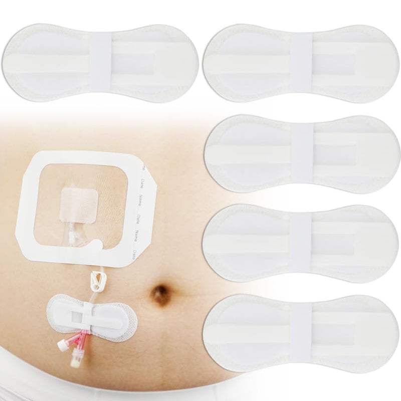 Low-Profile Catheter Stabilization Device for Kids Baby's Gtube Feeding Tube G J Tube Peg Pd Catheter Holder Peritoneal Dialysis Accessories Adhesive Patch Dressing (Pack of 20) Low Profile Tube Holder - 20 Pcs
