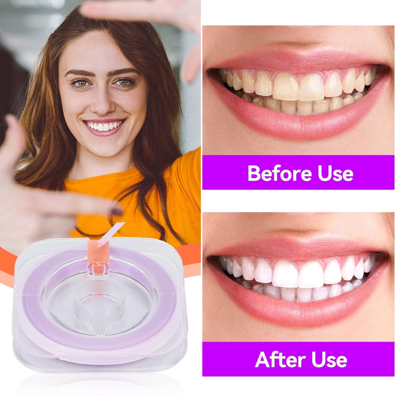 [Australia - AusPower] - Dental Sandpaper, Close Fit Tooth Polishing Grinding Strip Tooth Polish for Brighten Teeth 