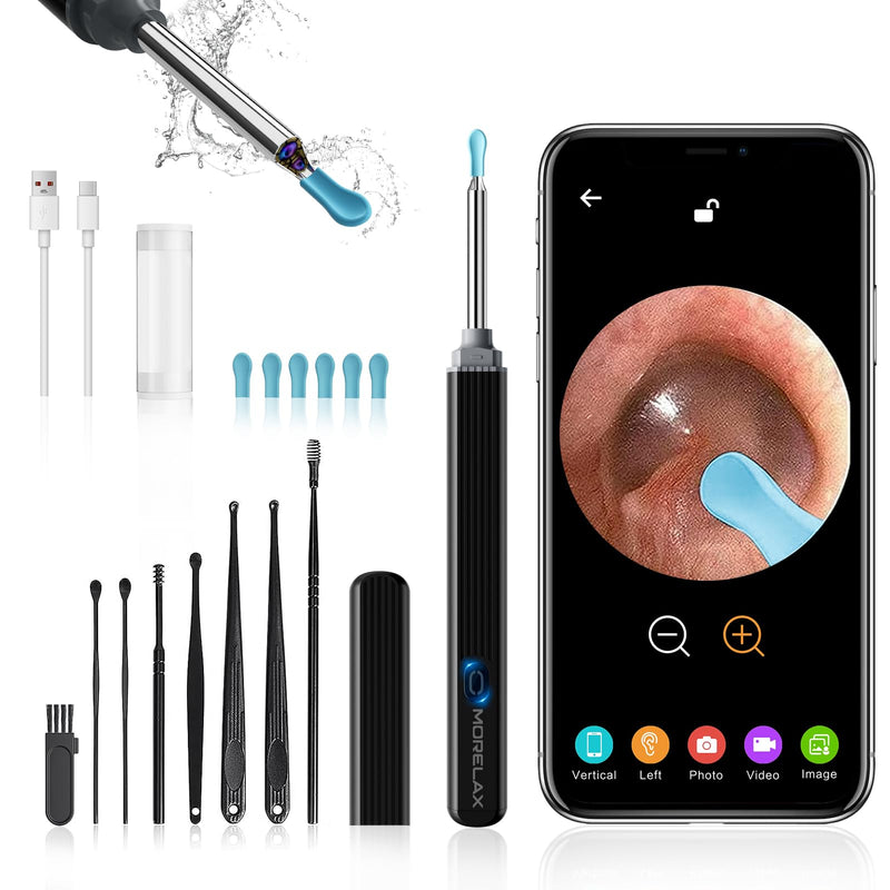 Earwax Remover Otoscope, Morelax 1080P WiFi Ear Cleaner, IP67 Waterproof with 360° Camera, Ear Endoscope with 6 LEDs for iPhone, Android, iPad, Adults, Children and Pets (Black) Black