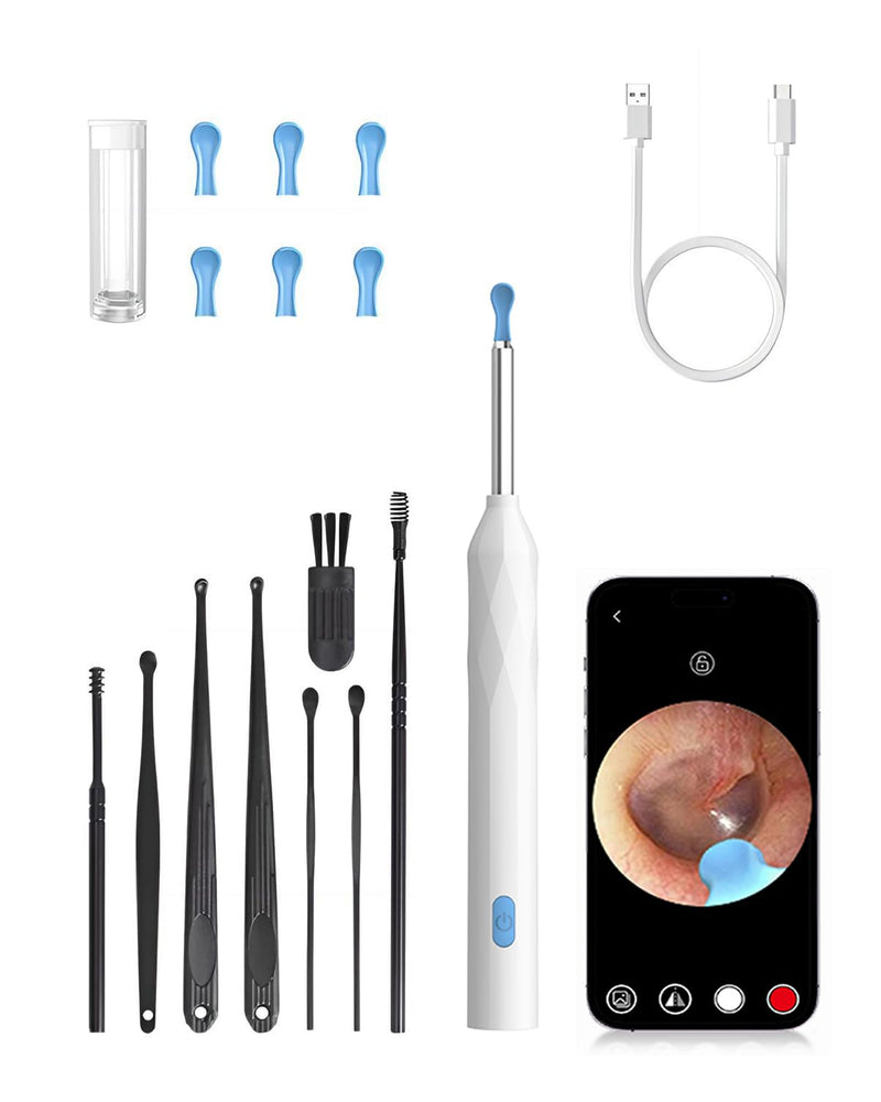 Ear Wax Remover Otoscope, WiFi 1080P HD Ear Cleaner, 360° Wide Angle Otoscope Camera for Otoscope IP67 Waterproof Otoscope Ear (White) White