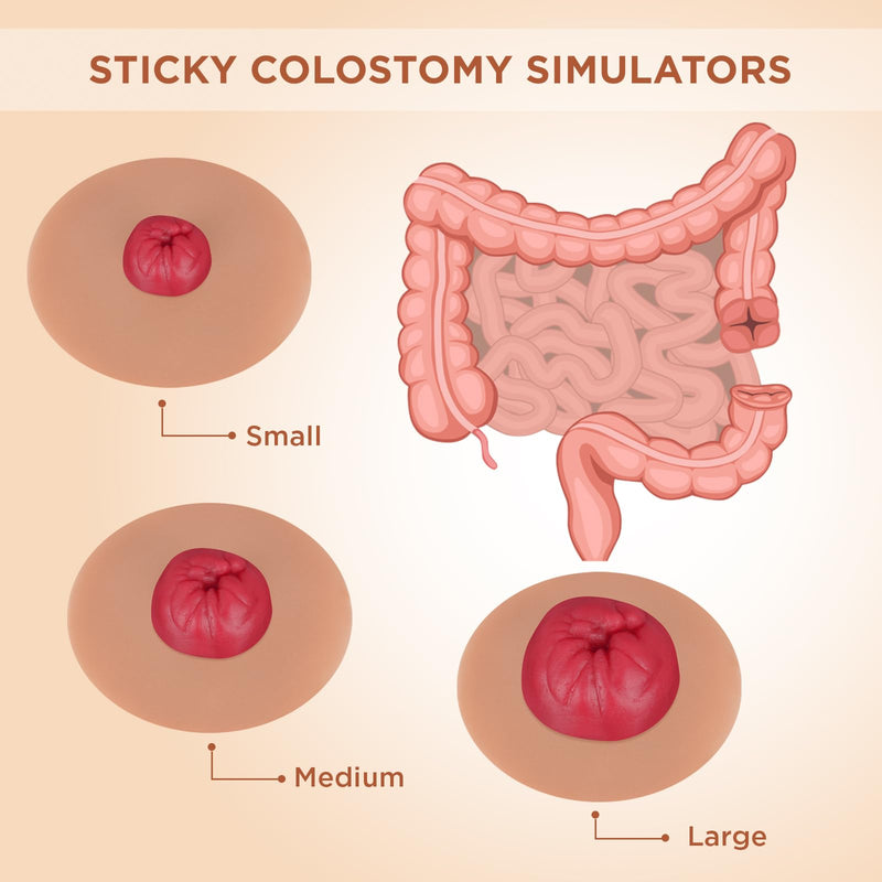 [Australia - AusPower] - Sticky Colostomy Simulators, Stoma Training Model Set, Multi-Skin Tone Ostomy Care Practice Models for Medical Training and Patient Education- Tan 
