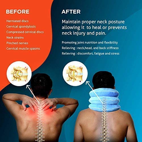 [Australia - AusPower] - NeckFix Cervical Neck Traction Device for Instant Neck Pain Relief - Pinched Nerve Neck Stretcher for Home Pain Treatment + Bonus (12-17 inch) 
