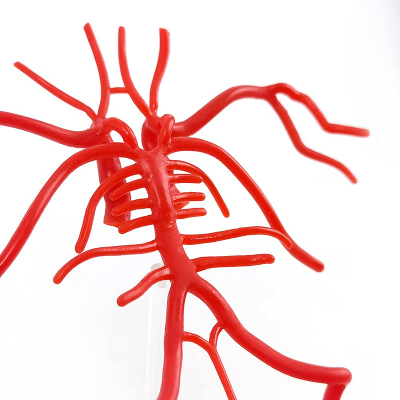 [Australia - AusPower] - Evotech Brain Artery Model, Life Size Intracranial Artery Model, Shows Internal Carotid Artery, Willis Circle and Basillary Artery & Their Branches. On a Plexiglass Base 