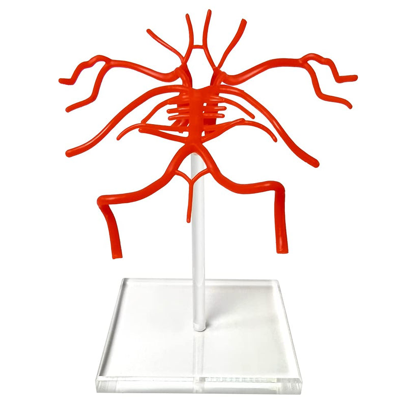 [Australia - AusPower] - Evotech Brain Artery Model, Life Size Intracranial Artery Model, Shows Internal Carotid Artery, Willis Circle and Basillary Artery & Their Branches. On a Plexiglass Base 