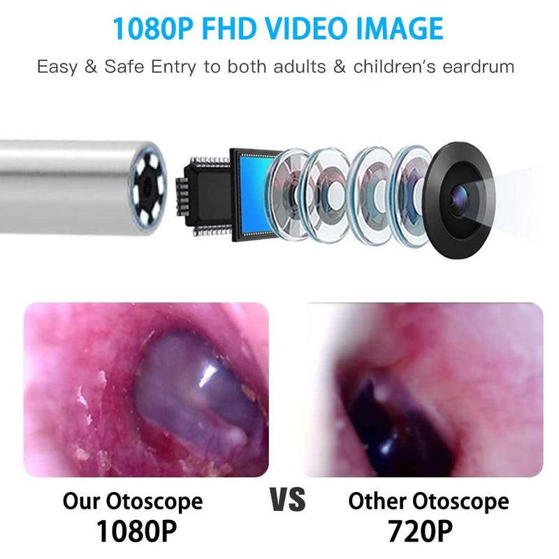 [Australia - AusPower] - Ear Wax Removal Endoscope Otoscope, Earwax Remover Tools, Scope, with 1080P FHD Camera, 6 Led Lights, Wireless Connected, Compatible with iPhone, iPad, Android Smart Phones & Tablets (White) 