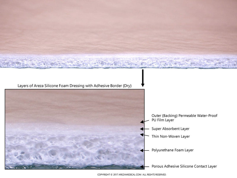 [Australia - AusPower] - Ultra-Absorbent Silicone Foam Dressing with Border (Adhesive) Waterproof 6" X 6" (15 cm X 15 cm) (Central Ultra Absorbent-Foam Pad is 4.15" X 4.15") 5 Per Box (1); Wound Dressing by Areza Medical 1 