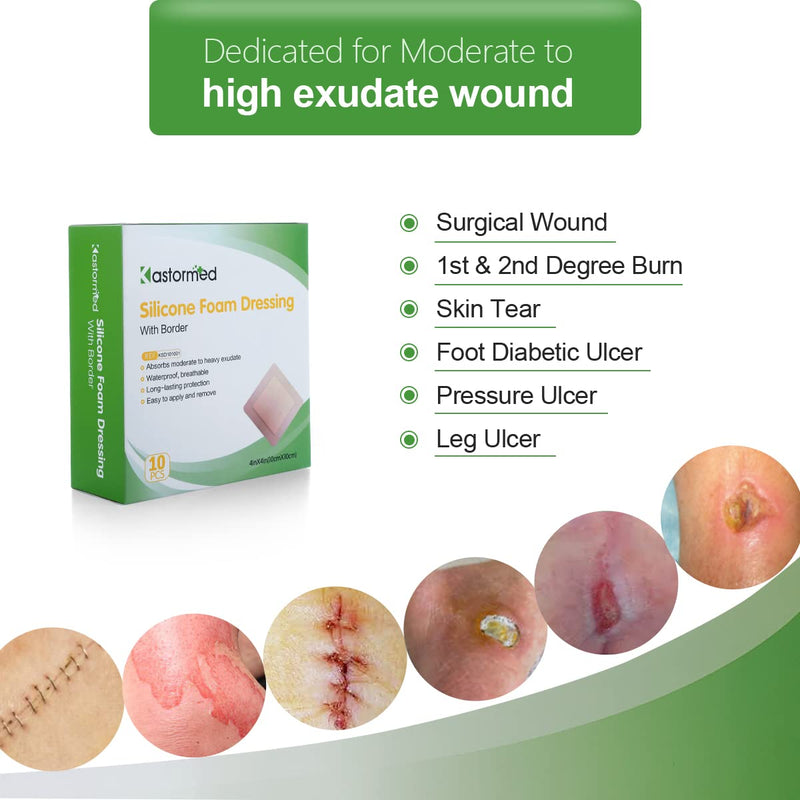 [Australia - AusPower] - Silicone Adhesive Foam Dressing with Gentle Border 4''x4'' 10 Pack, High Absorbency Foam Wound Bandage for Bed Sore, Leg Ulcer, Diabetic Ulcer 4'' x 4'' - 10 Pack 
