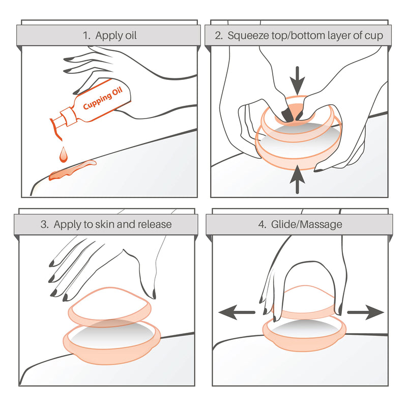 [Australia - AusPower] - Edge Cupping Therapy Sets - Silicone Vacuum Suction Cupping Cups – Muscle, Nerve, Joint Pain Relief (Clear) (6 Piece Set) 6 Piece Set 