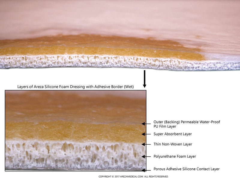 [Australia - AusPower] - Ultra-Absorbent Silicone Foam Dressing with Border (Adhesive) Waterproof 6" X 6" (15 cm X 15 cm) (Central Ultra Absorbent-Foam Pad is 4.15" X 4.15") 5 Per Box (1); Wound Dressing by Areza Medical 1 