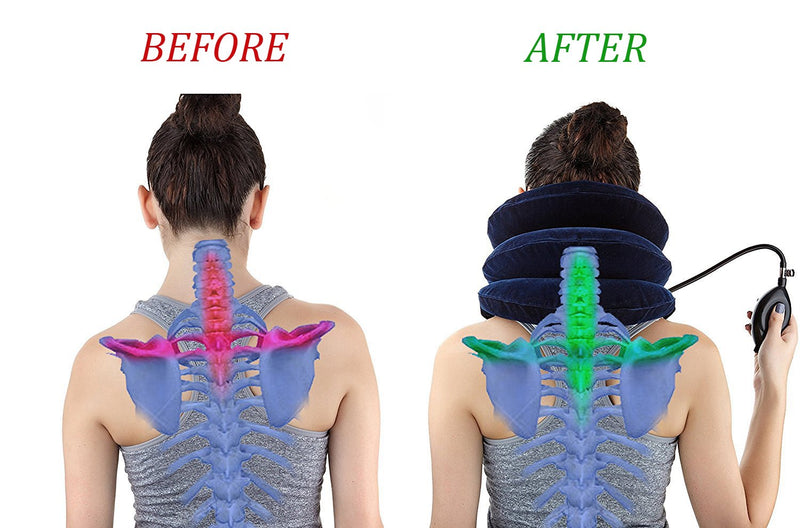 [Australia - AusPower] - Cervical Neck Traction Device Inflatable Neck Stretcher, Easy to Use for Chronic Neck and Shoulder Pain Relief, Neck Cervical Brace Collar Pillow for Hom Blue 