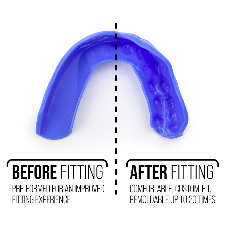[Australia - AusPower] - Sports Mouth Guard by SISU 3D 2.0mm Easy-to-Fit, Custom Fit Mouth Guard for Football, Hockey, Lacrosse, Basketball for Youth/Adults Charcoal Black 