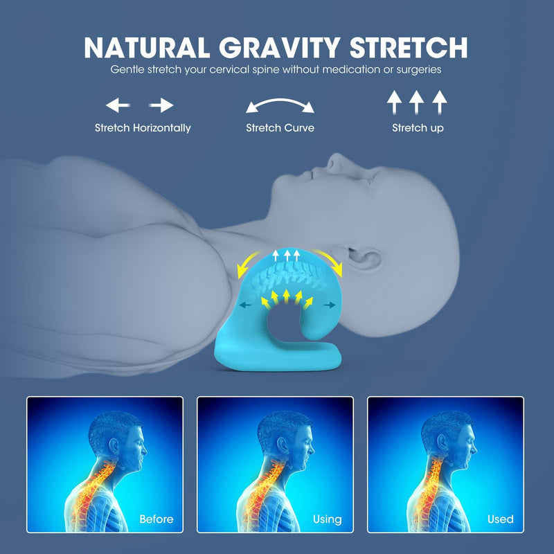 [Australia - AusPower] - ZAMAT Neck and Shoulder Relaxer with Magnetic Therapy Pillowcase, Neck Stretcher Chiropractic Pillows for Pain Relief, Cervical Traction Device for Relieve TMJ Headache Muscle Tension Spine Alignment Grey 
