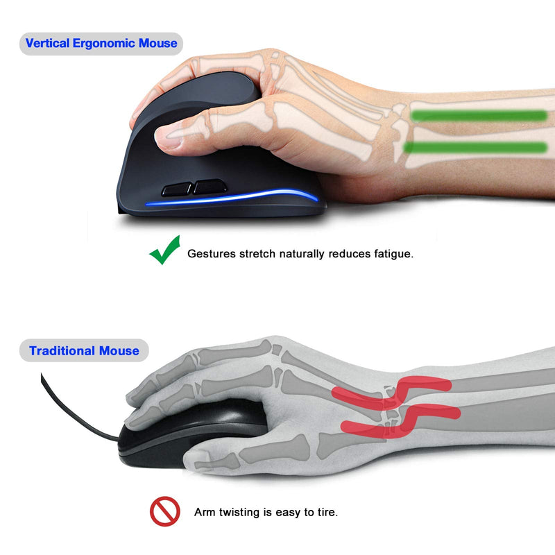 [Australia - AusPower] - TRELC Ergonomic Mouse, 2.4G Wireless Vertical Optical Mouse with Adjustable Sensitivity (1000/1600/2400 DPI), 6 Buttons for PC, Desktop, Laptop, Notebook (Black) 2.4GHz 
