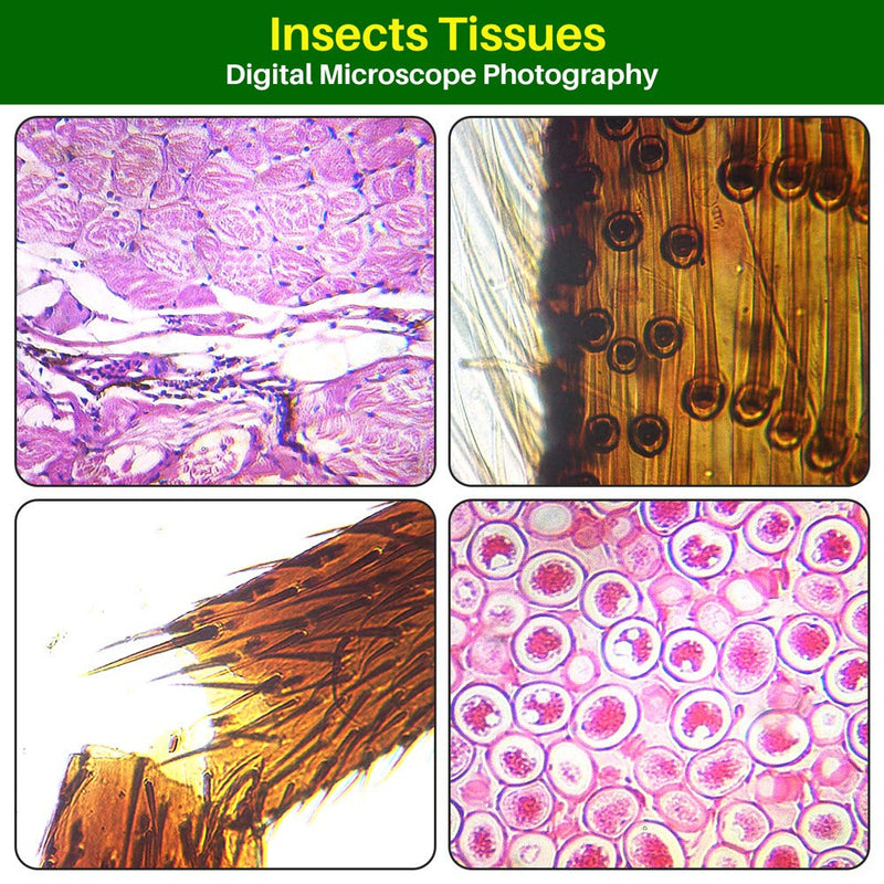 [Australia - AusPower] - Microscope Slides Prepared Lab Specimens Set-50 PCS Collection, Biology Sample with Insects Plants Animals for Students Kids Home School Science Learning 