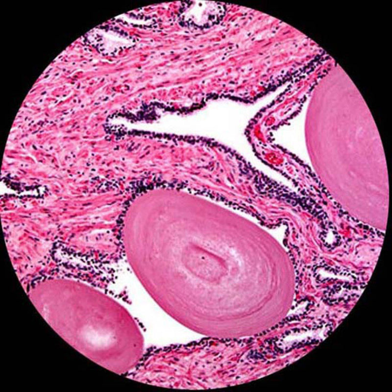 [Australia - AusPower] - AmScope PS50 Prepared Microscope Slide Set for Basic Biological Science Education, 50 Slides, Includes Fitted Wooden Case 