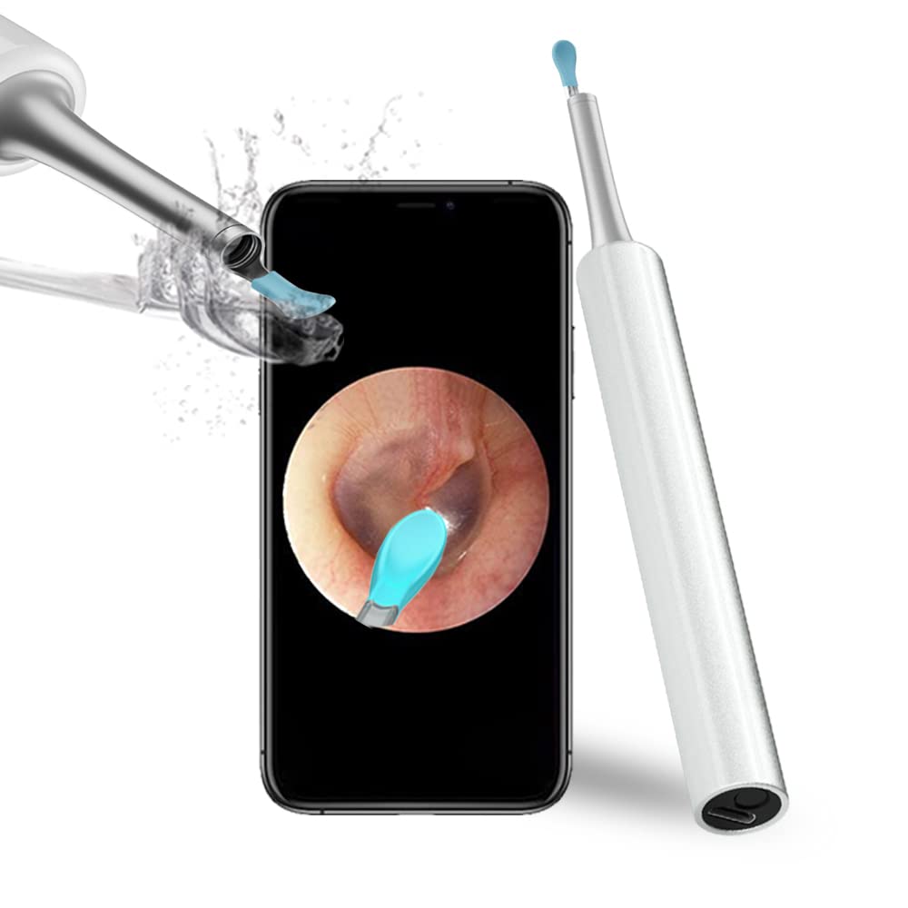 [Australia - AusPower] - Ear Wax Removal Endoscope Otoscope, Earwax Remover Tools, Scope, with 1080P FHD Camera, 6 Led Lights, Wireless Connected, Compatible with iPhone, iPad, Android Smart Phones & Tablets (White) 