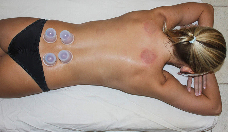 [Australia - AusPower] - Cupping Therapy Set Massage Cups - by DoSensePro - Acupuncture Home Cupping Therapy Set for Arthritis, Pain Relief, Anti Aging, Anti Cellulite - Best Relaxation Gift - 6 Silicone Vacuum Cups 