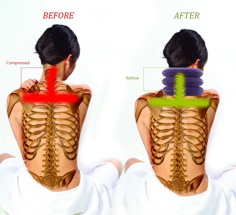 [Australia - AusPower] - Cervical Neck Traction Device Inflatable Neck Stretcher, Easy to Use for Chronic Neck and Shoulder Pain Relief Traction Spine Alignment, Neck Cervical Brace Purple 