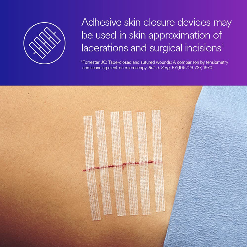[Australia - AusPower] - 3M™ Steri-Strip™ Reinforced Adhesive Skin Closures, R1547, 1/2 in x 4 in (12 mm x 100 mm), 6 Strips/Envelope 