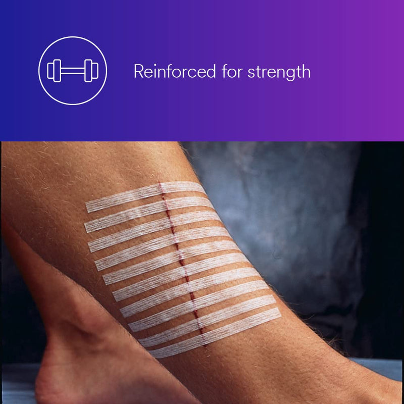 [Australia - AusPower] - 3M™ Steri-Strip™ Reinforced Adhesive Skin Closures, R1547, 1/2 in x 4 in (12 mm x 100 mm), 6 Strips/Envelope 